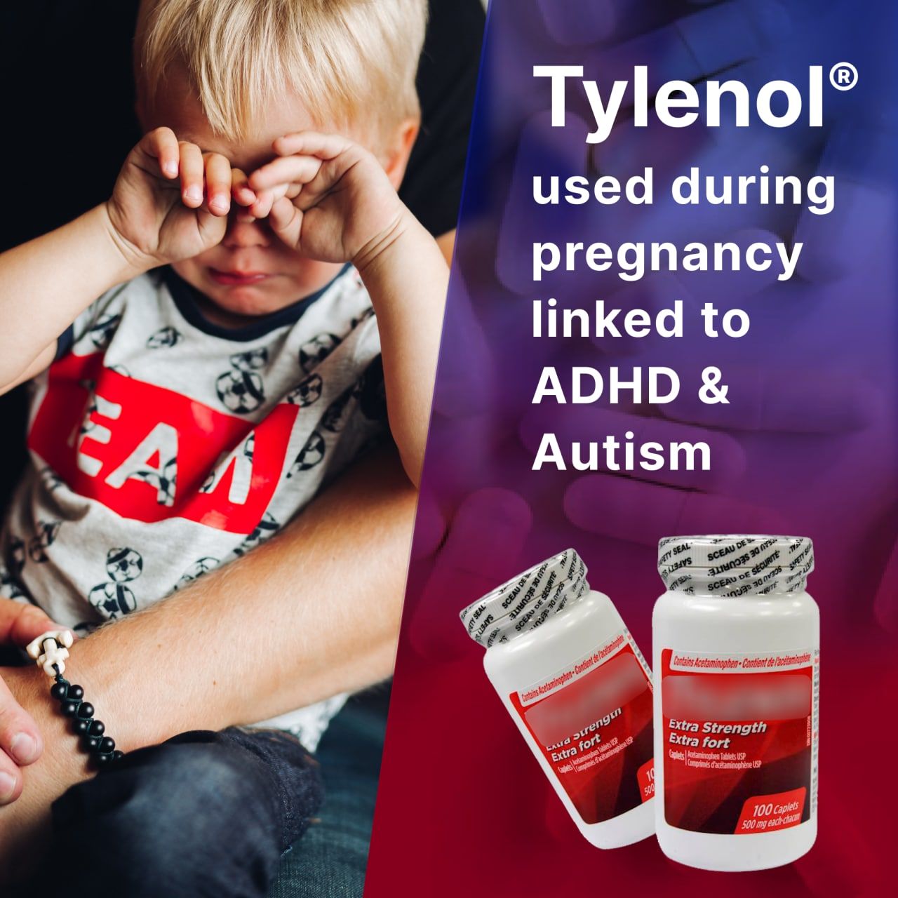 💊Tylenol® used during pregnancy linked to ADHD & Autism by Multiple Studies